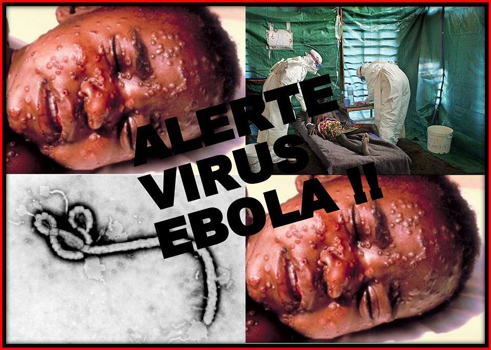 Ebola Pictures 108